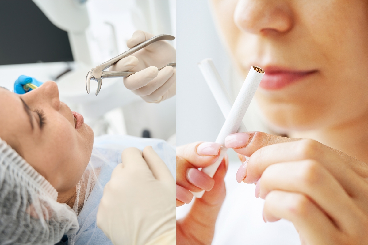 how long after wisdom teeth removal can i smoke vape How Long to Not Smoke Before Wisdom Teeth Removal? main image 1