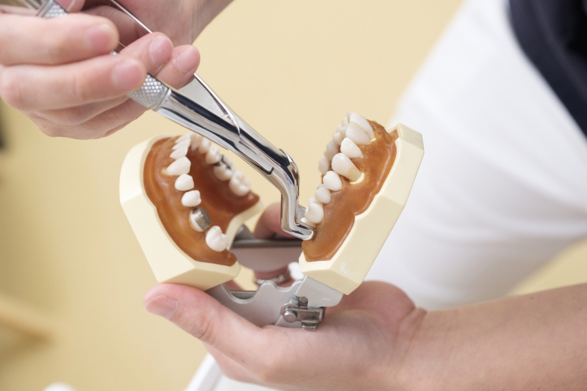 Does Wisdom Teeth Extraction Change Face Shape?