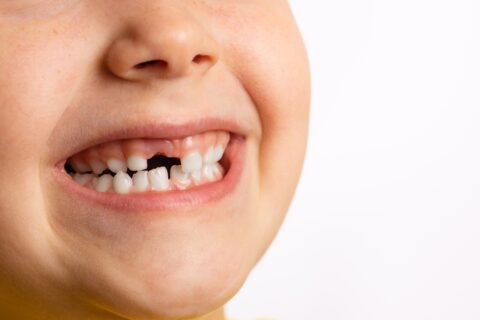 Does Your Child’s Permanent Tooth Still Grow If It’s Broken