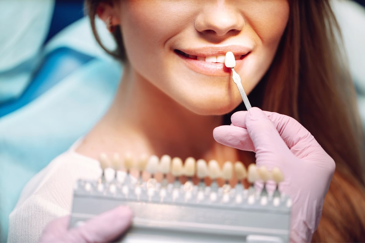 Is Teeth Shaving Necessary for Veneers? What You Need to Know