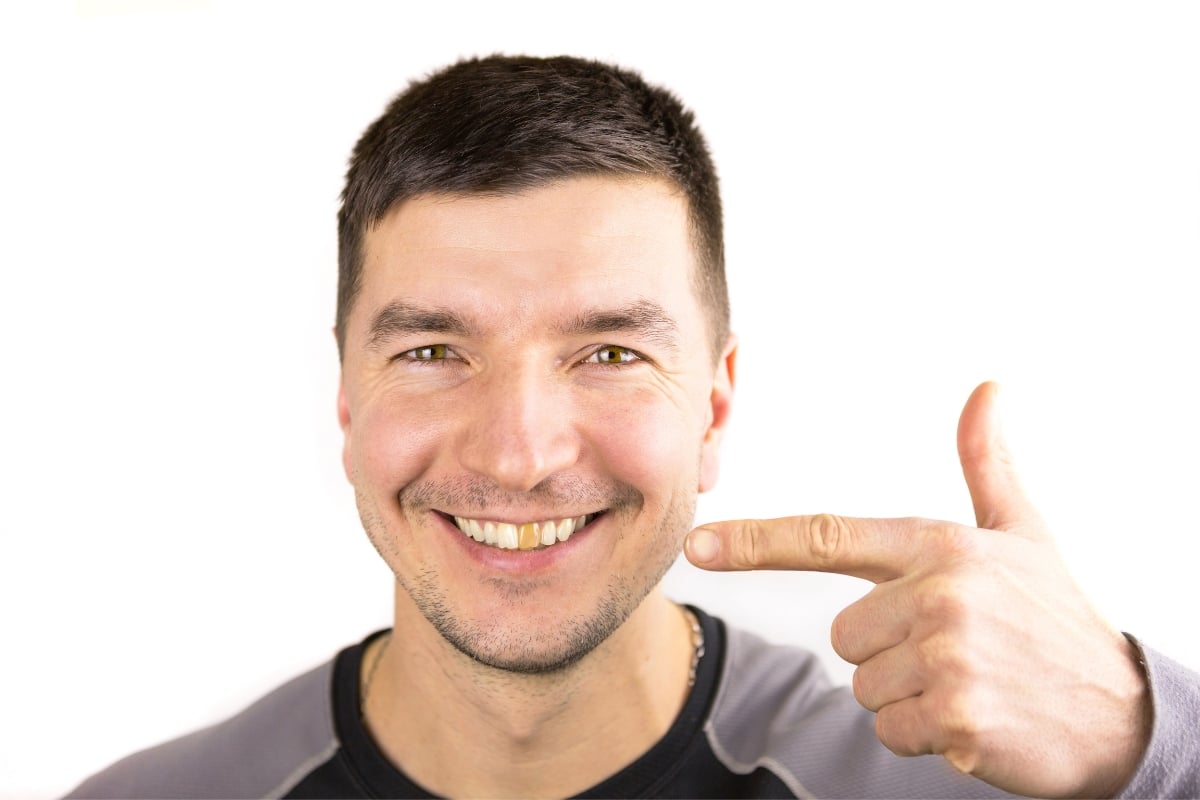 Tooth Turning Black But No Pain? Discover The Reasons