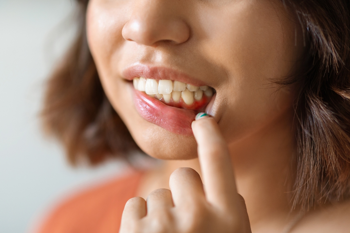 What Is the Best Antibiotic for a Gum Infection
