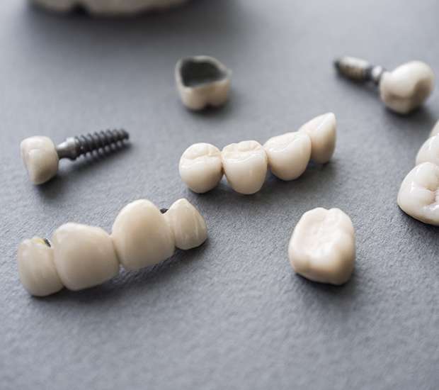 Round Rock The Difference Between Dental Implants and Mini Dental Implants